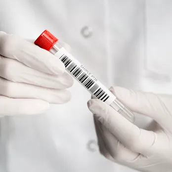 Medical professional holding test tube with barcode label
