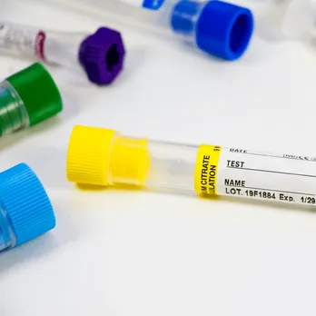 Medical label on white surface with colored vials